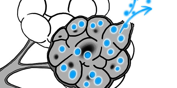 Air Trapping Ausschnitt Quiz Bbe