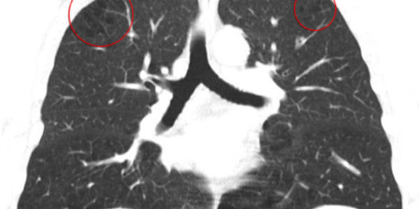 Tauchlehrerkarriere Lunge Eccaed